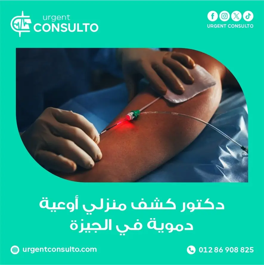 دكتور كشف منزلي أوعية دموية في الجيزة