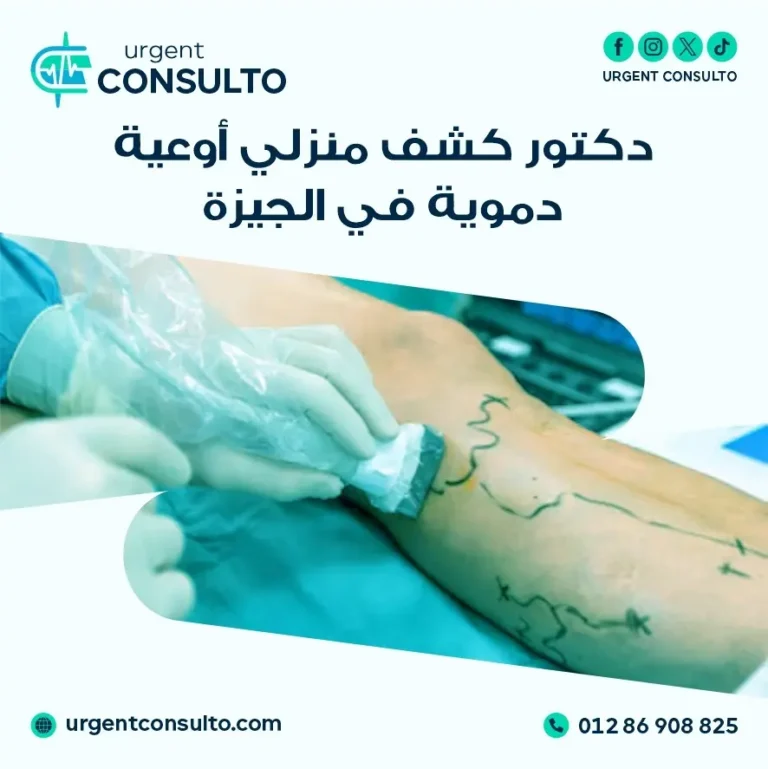 دكتور كشف منزلي أوعية دموية في الجيزة